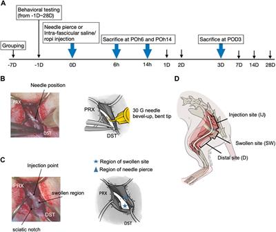 Sciatic Nerve Intrafascicular Injection Induces Neuropathy by Activating the Matrix Modulators MMP-9 and TIMP-1